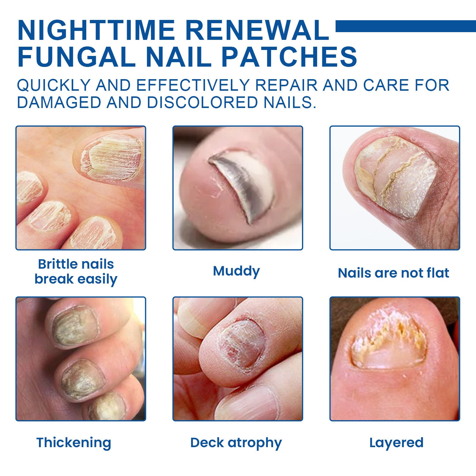 Ximonth Fungal Nail Patches 32-Pack | 8-Hour Overnight Nighttime Nail Treatment | Reduces Discoloration & Thickness Fast