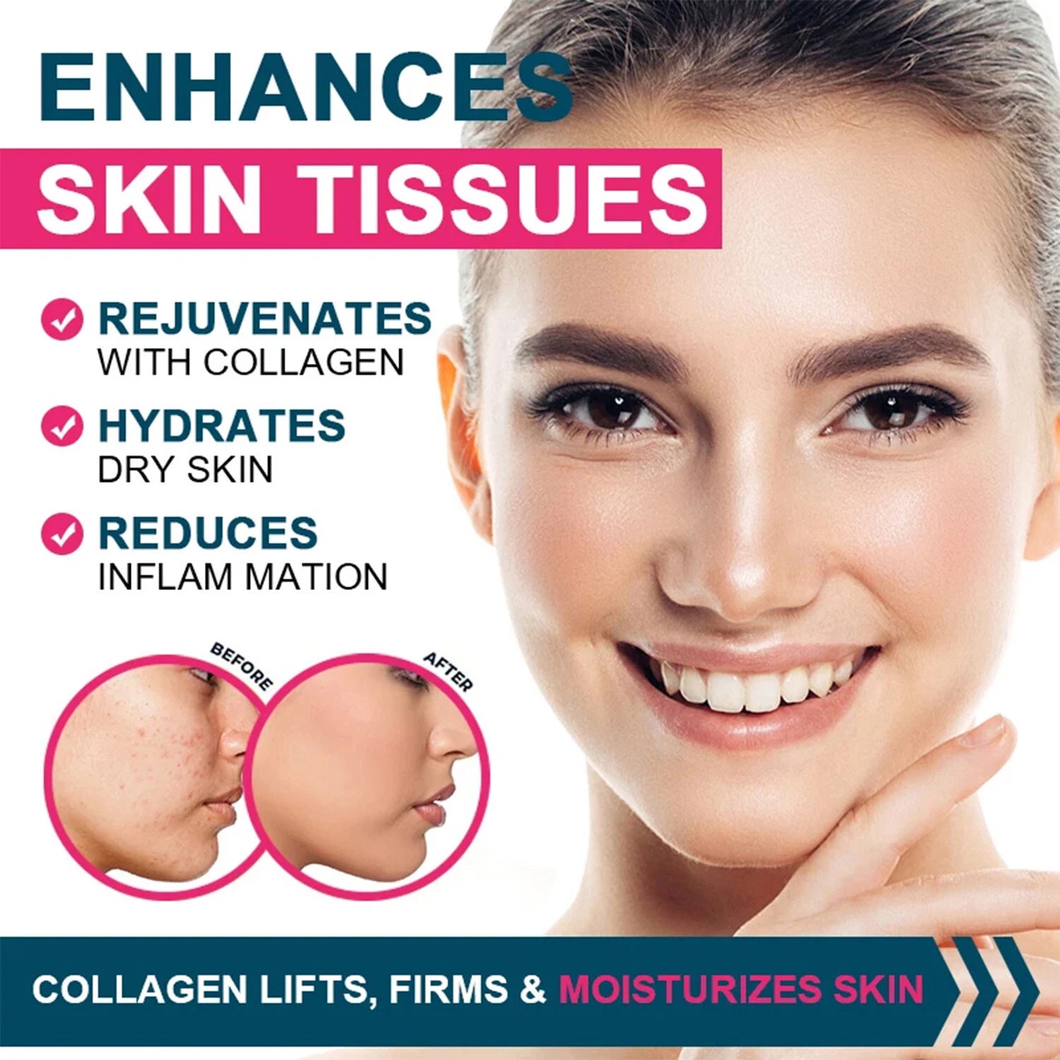 Multi Collagen Capsules Type I II III V & X | 5-in-1 Extra Strength 1800mg 120 Capsules Skin Hair Nails Joint & Immune Support for Men & Women