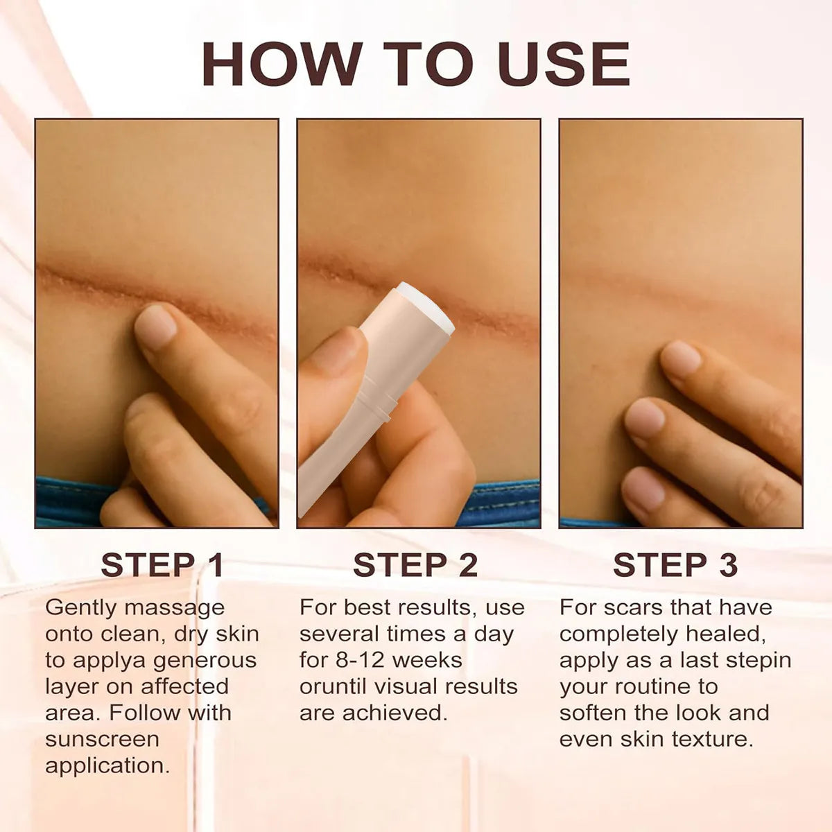 Silicone Scar Stick Set of 2 – Scar Solutions Scar Removal Treatment for Old & New Scars, Surgery, Acne & Stretch Marks