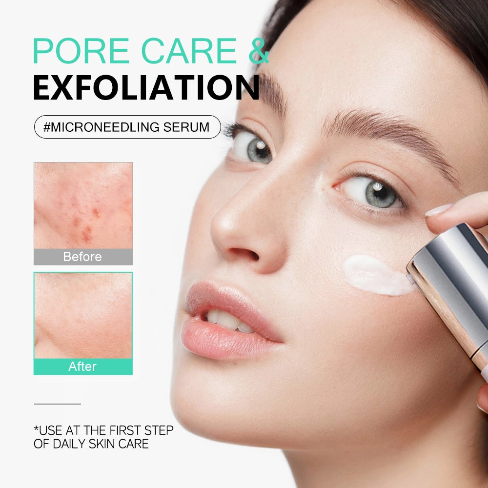 KOEC Cica Centella Microneedling Serum Set of 2 | Smooth & Soothe Skin 50ml Daily Use