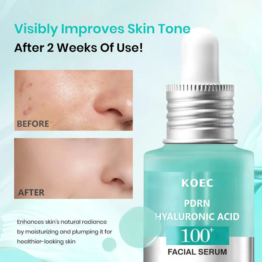 KOEC PDRN Hyaluronic Acid 100+ Facial Serum Set of 2 | Deep Moisturizing Dry & Dull Skin 30ml