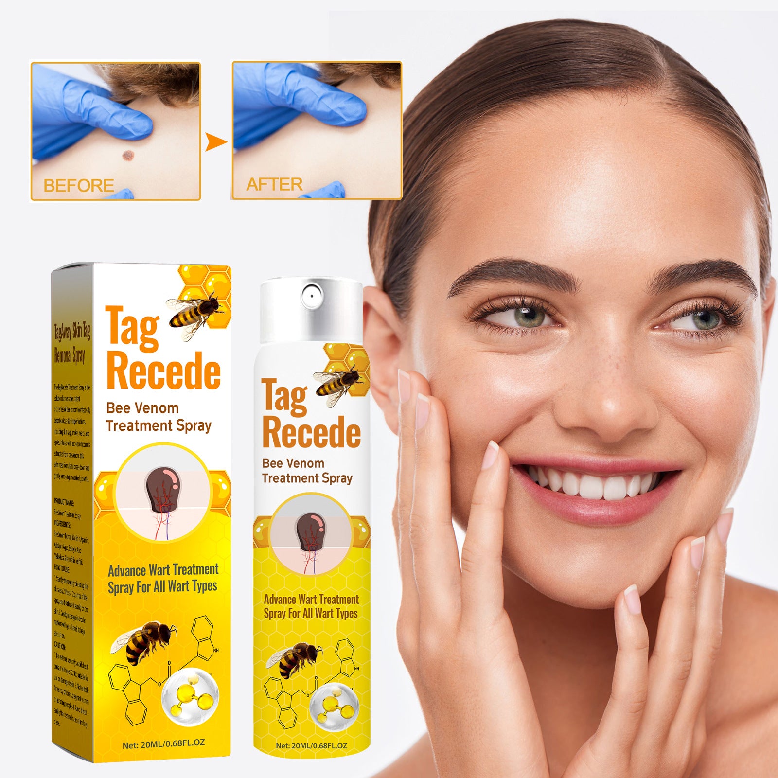 Tag Recede Bee Venom Skin Tag Removal Spray | Advanced Wart Treatment for All Wart Types | 20ml Fast Acting Formula