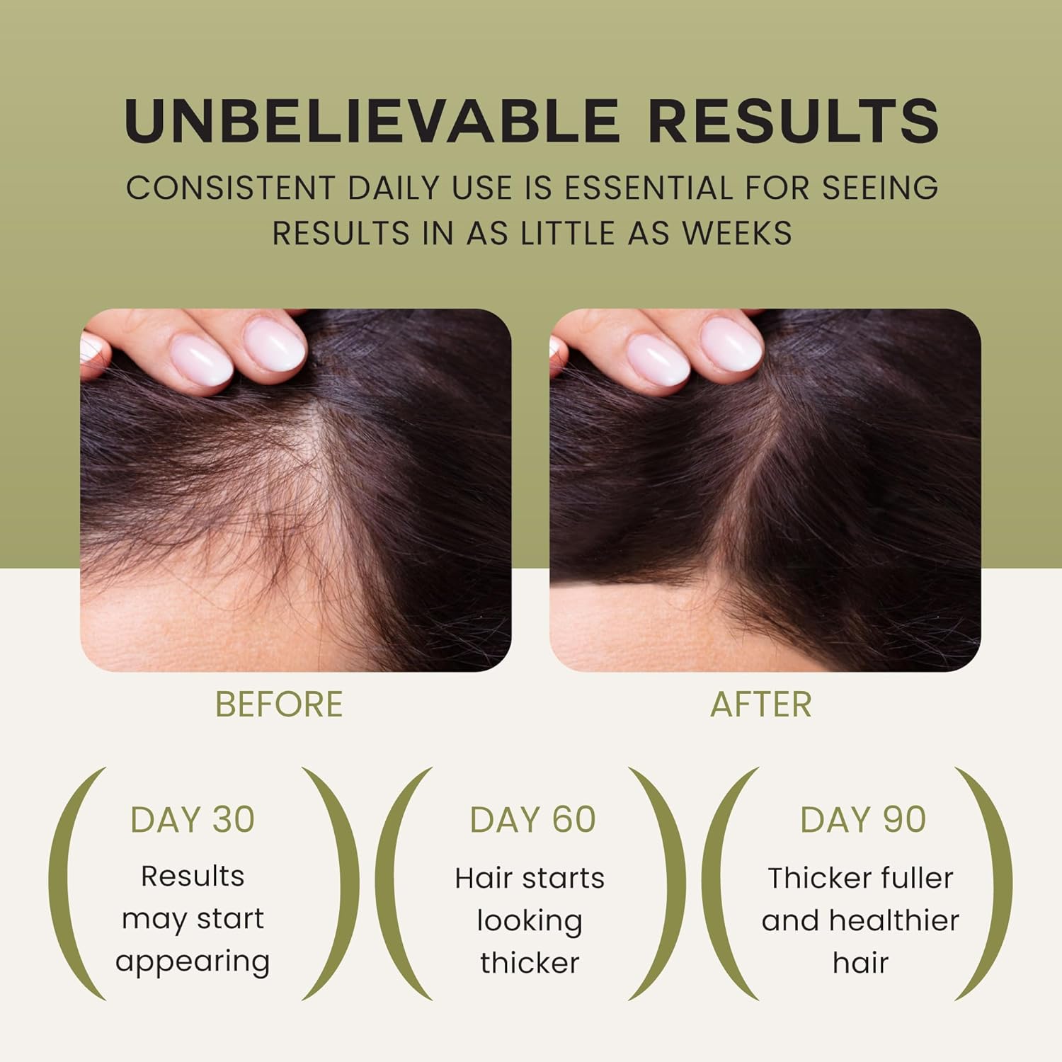 Lebanta Wonder Growth Oil | Batana, Castor, Rosemary & Coconut Oil for Hair Growth | All Hair Types | 4 fl oz