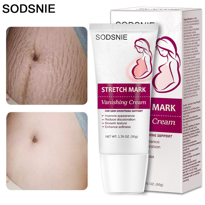 SODSNIE Stretch Mark Vanishing Cream | Skin Smoothing, Discoloration Reducing & Softening Body Cream ? 50g