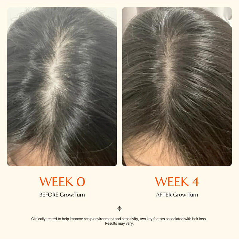 Grow Turn Scalp Ampoule 100ml with BioExo Water and Scalp Clera Biotechnology Hair Growth Scalp Treatment