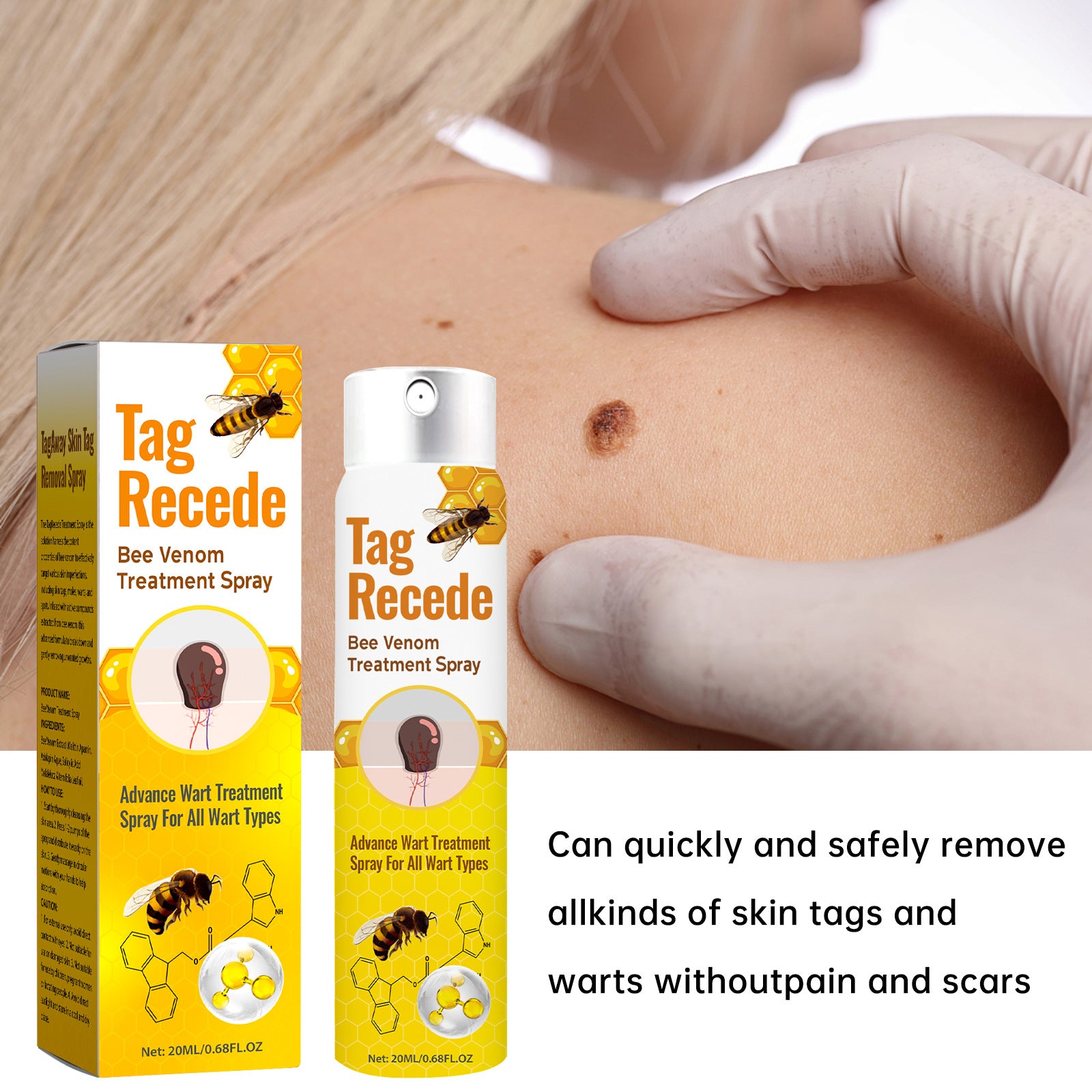 Tag Recede Bee Venom Skin Tag Removal Spray | Advanced Wart Treatment for All Wart Types | 20ml Fast Acting Formula