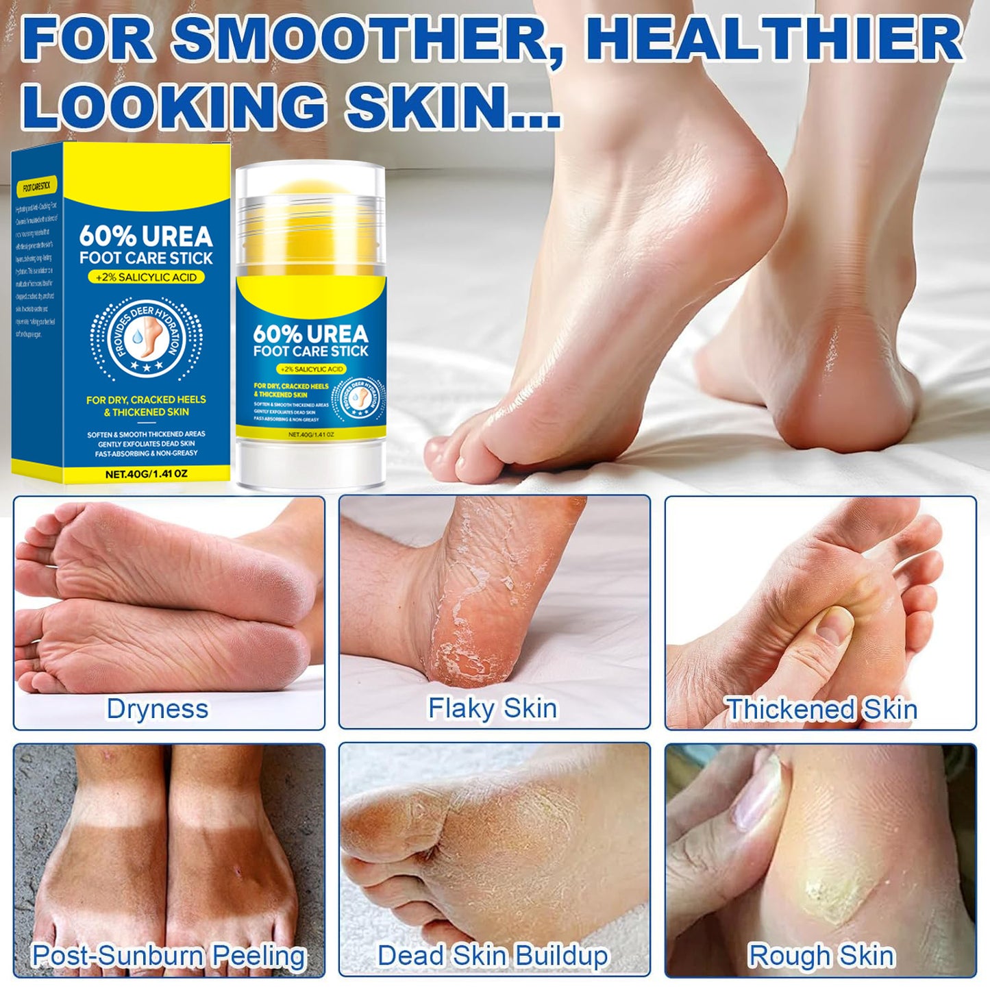 60% Urea Foot Care Stick + 2% Salicylic Acid | Deep Hydration for Dry Cracked Heels & Thickened Skin | Fast Absorbing Non-Greasy Foot Balm | 40g