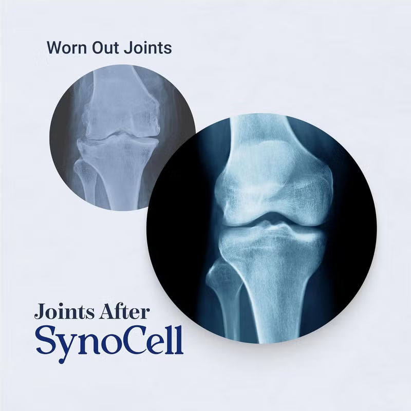 مجموعة مكمل SynoCell لصحة المفاصل من قطعتين | 60 كبسولة | تحرك بحرية وسهولة | دعم الغضاريف وتدفق الدم ومرونة المفاصل