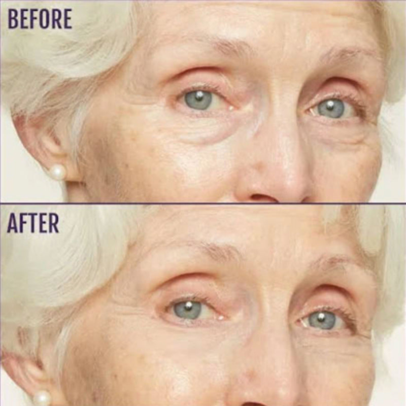 Revive Eye Cream for Face & Neck | Probiotic + Retinal + Peptide | All Skin Types 40ml