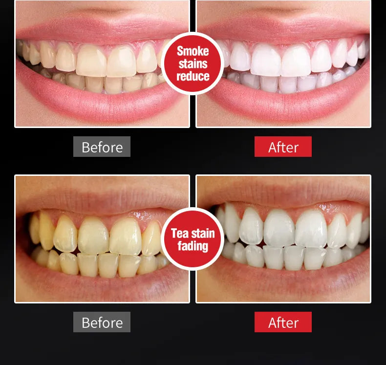 SP-6 Super Probiotic Whitening Toothpaste Set of 6 | Brightening+ Oral Microbiota Strength | 140g Each