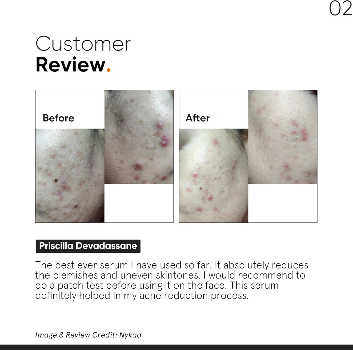 Minimalist Niacinamide 10% Face Serum Set of 3 | Regulates Sebum & Evens Skin Tone | 10ml