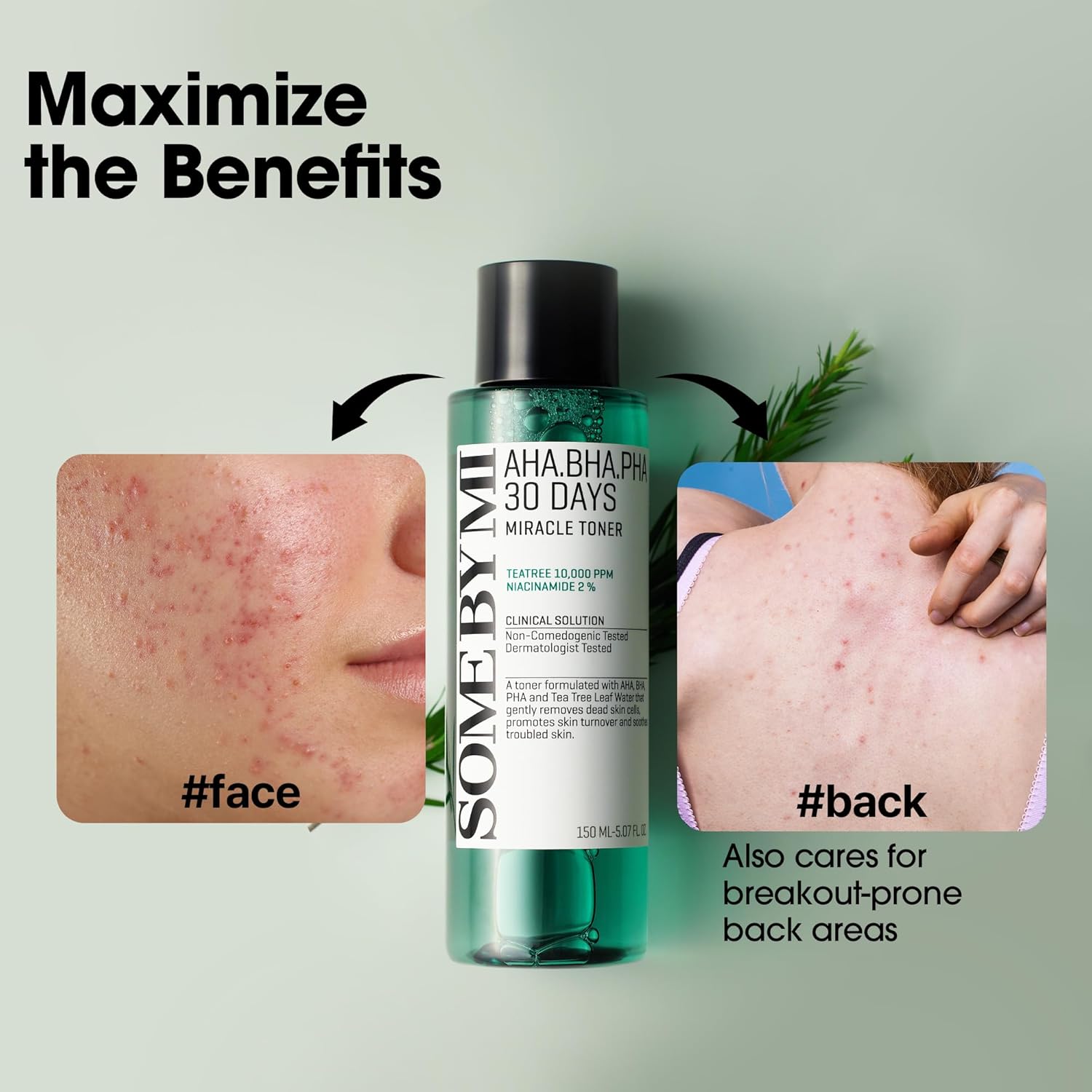 Some By Mi AHA BHA PHA 30 Days Miracle Toner Set of 2 | Tea Tree 10000 PPM and Niacinamide 2% | 150ml x2 | Korean Skincare Clinical Solution