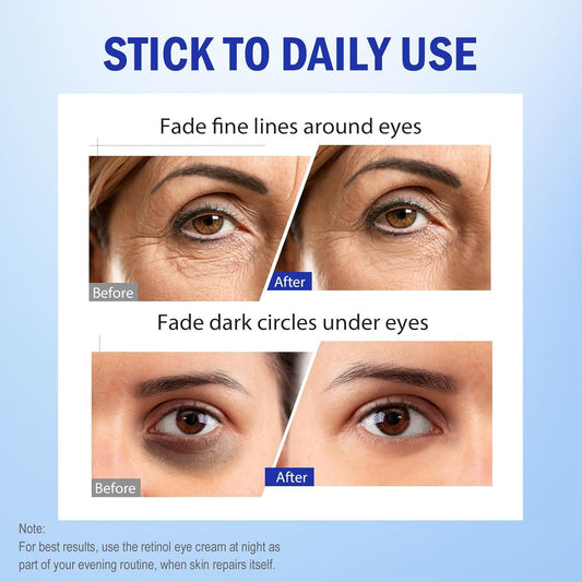 Revive Eye Cream for Face & Neck | Probiotic + Retinal + Peptide | All Skin Types 40ml