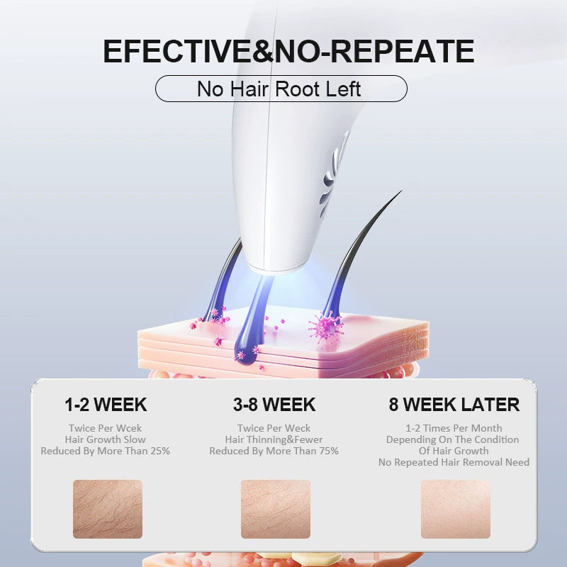 IPL Hair Removal Device | Permanent Painless At-Home Laser Hair Remover Machine with LCD Display