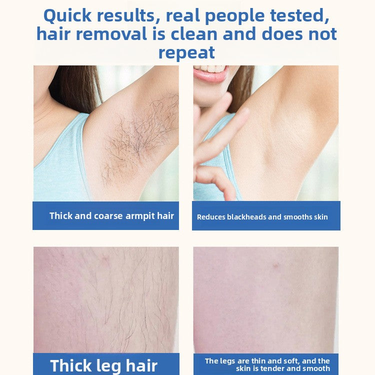 IPL Hair Removal Device Kit 999999 Flashes | Permanent Painless Laser Hair Remover | Includes Goggles & Razor | LCD Display