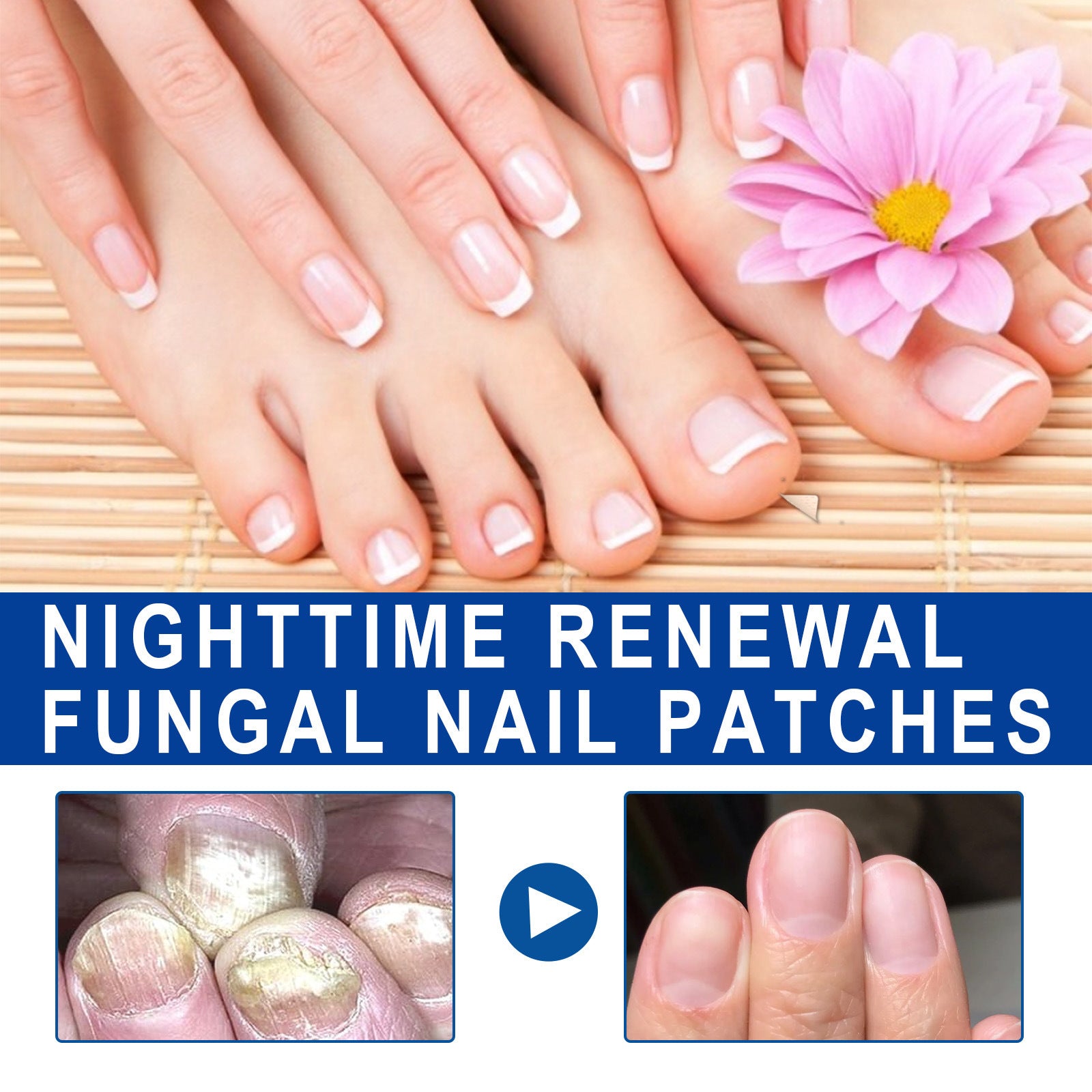 Ximonth Fungal Nail Patches 32-Pack | 8-Hour Overnight Nighttime Nail Treatment | Reduces Discoloration & Thickness Fast