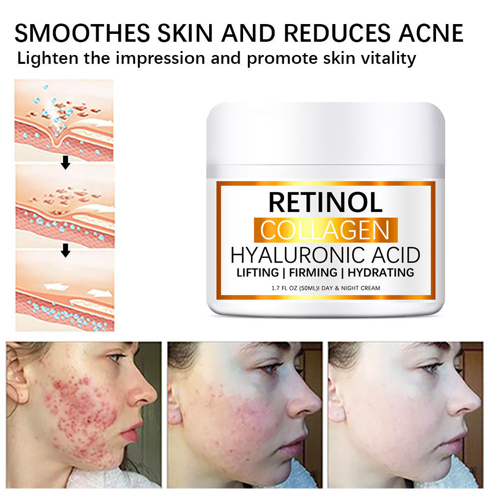 Retinol Collagen Hyaluronic Acid Day & Night Cream 50ml | Lifting, Firming & Hydrating | Anti-Aging Face Moisturizer