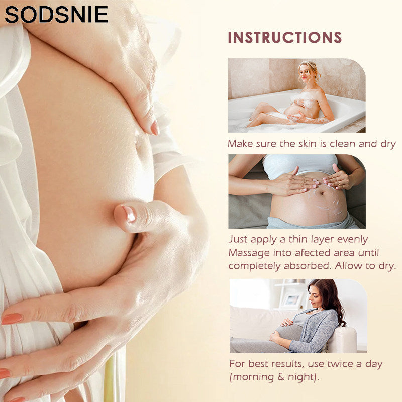 SODSNIE Stretch Mark Vanishing Cream | Skin Smoothing, Discoloration Reducing & Softening Body Cream ? 50g